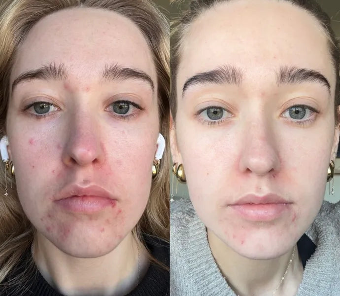 Anti-Vermoeidheid Masker – Herstel je Huid in 10 Minuten